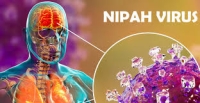 Virus Nipah. Foto:Google.