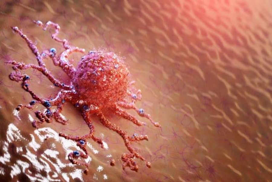 Médiku HNGV alerta komunidade evita fatór risku kankru, deteksaun sedu bele salva vida