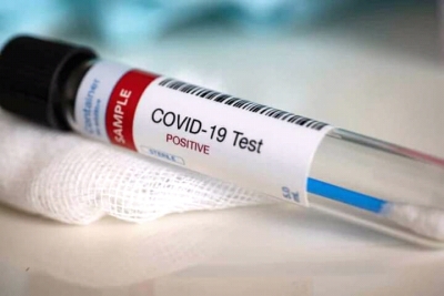 Rezultadu teste PCR hatudu, pozitivu Covid-19. Foto: Dok.